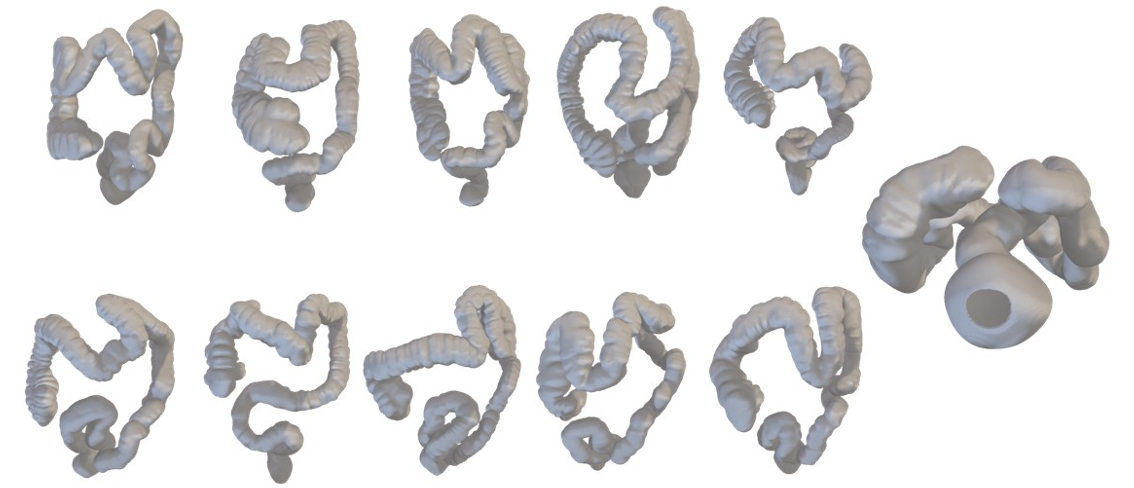 New Open Dataset of 435 Clinically Validated Human Colons